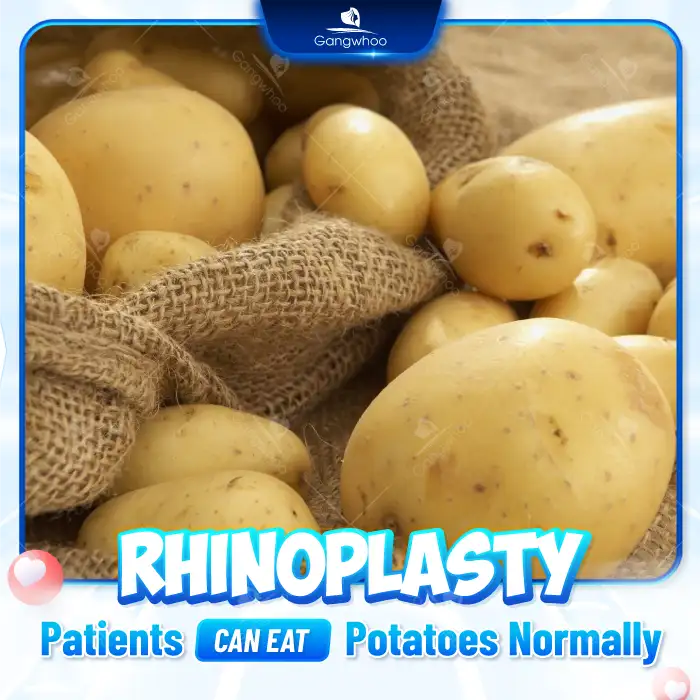 Can you eat potatoes after rhinoplasty? Which food groups should be supplemented? 1 Can you eat potatoes after rhinoplasty? Which food groups should be supplemented?