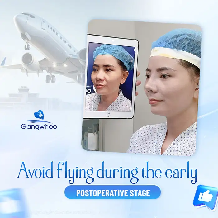 How long after rhinoplasty can you travel by plane? What should you be aware of? 1 How long after rhinoplasty can you travel by plane? What should you be aware of?