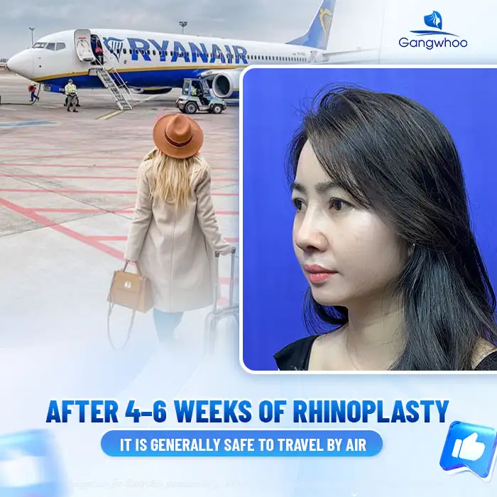 How long after rhinoplasty can you travel by plane? What should you be aware of? 2 How long after rhinoplasty can you travel by plane? What should you be aware of?