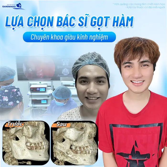 Gọt hàm bị lệch nguyên nhân do đâu? Cách khắc phục tình trạng ra sao?