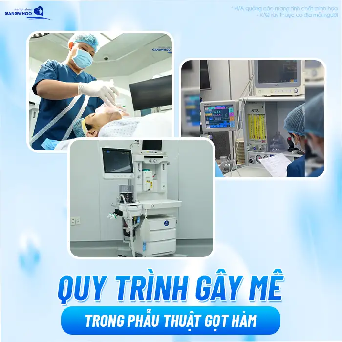 Gọt hàm hôn mê bao lâu? Quy trình gây mê diễn ra như thế nào?