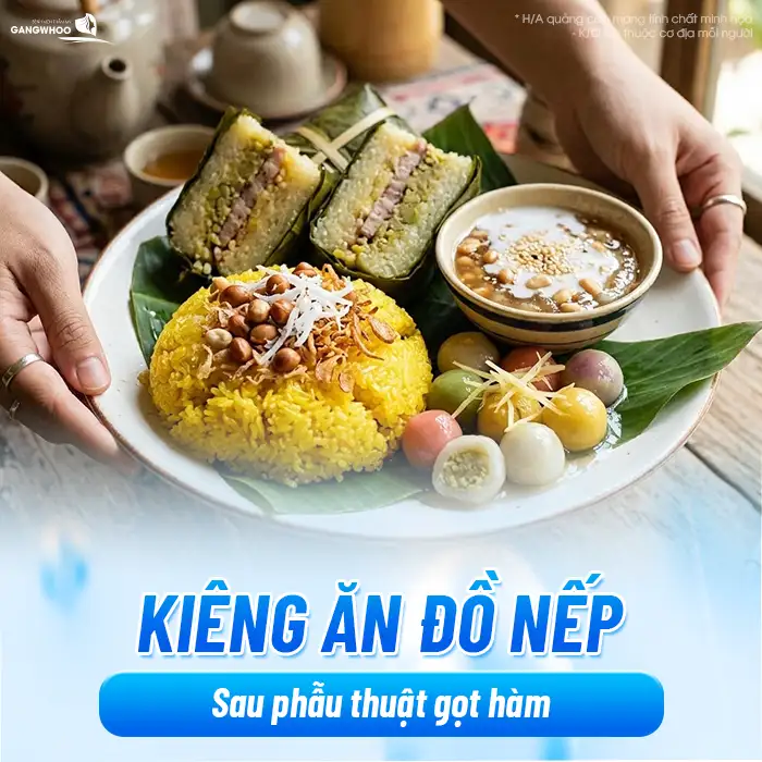 Gọt hàm kiêng ăn gì? Danh sách thực phẩm cần tránh để mau lành