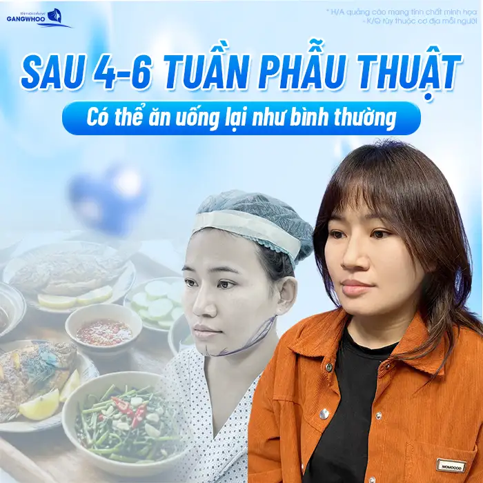 Gọt hàm kiêng ăn gì? Danh sách thực phẩm cần tránh để mau lành