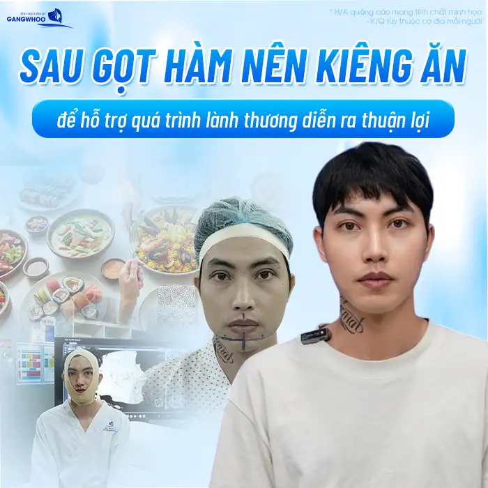 Gọt hàm kiêng ăn gì? Danh sách thực phẩm cần tránh để mau lành