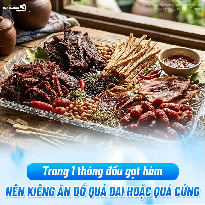 Gọt hàm kiêng ăn gì? Danh sách thực phẩm cần tránh để mau lành