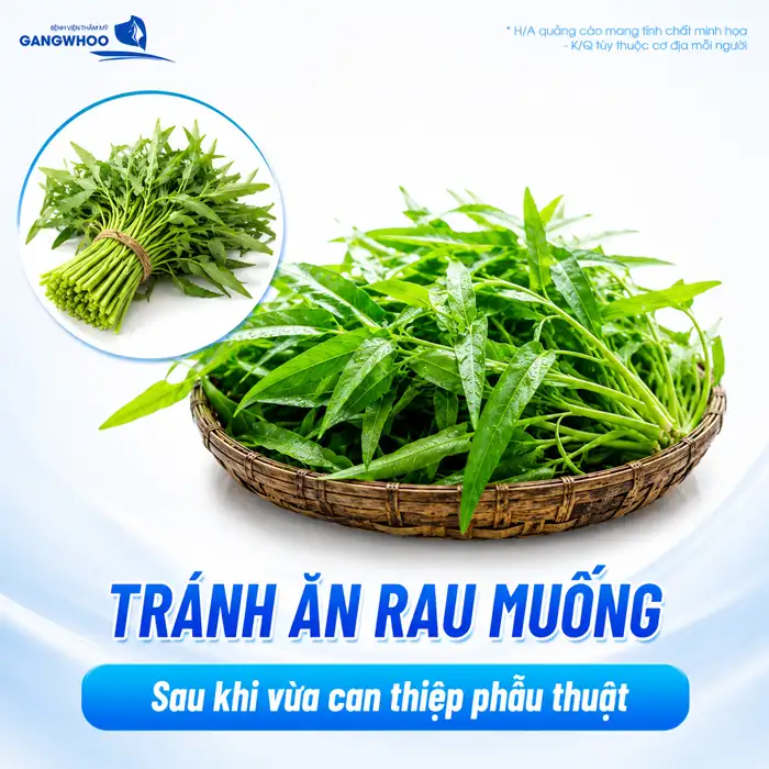 Gọt hàm kiêng ăn gì? Danh sách thực phẩm cần tránh để mau lành