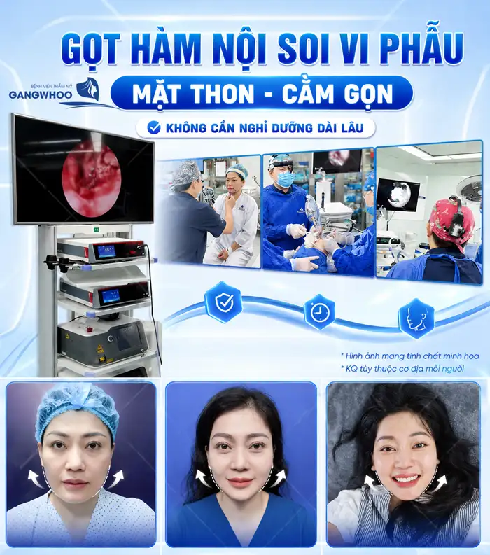 Gọt hàm nghỉ dưỡng bao lâu? Yếu tố ảnh hưởng thời gian nghỉ dưỡng