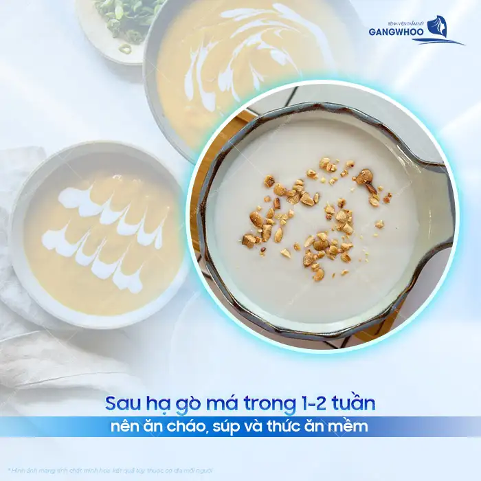 Hạ gò má cần kiêng những gì? Nên bổ sung loại thực phẩm nào?