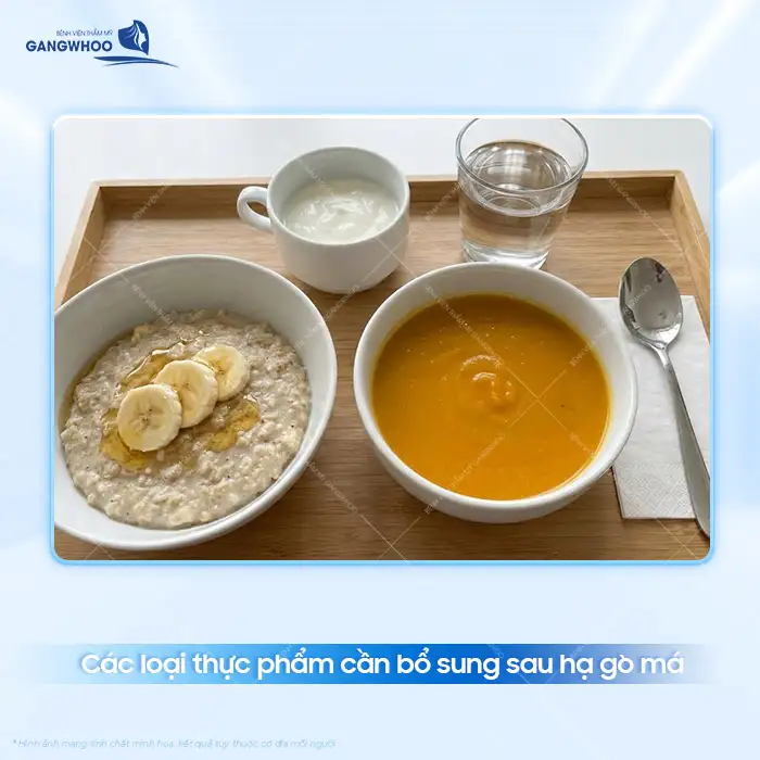 Hạ gò má cần kiêng những gì? Nên bổ sung loại thực phẩm nào?