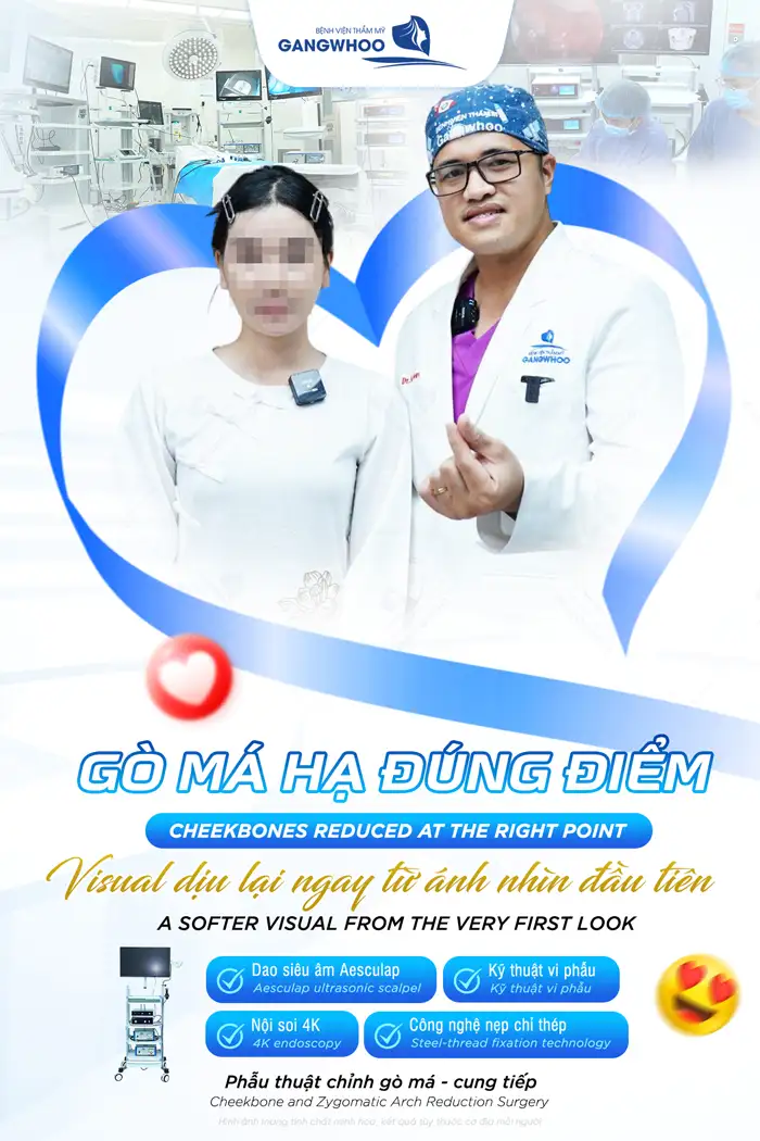 Hạ gò má giá bao nhiêu tiền? Chi phí hạ gò má cập nhật mới 2025