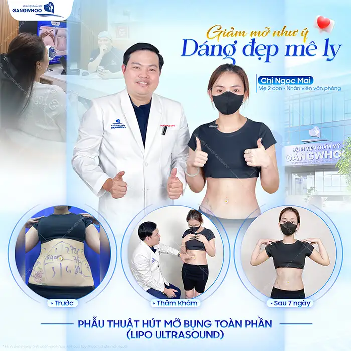 Hút mỡ bằng sóng siêu âm là gì? Có an toàn và hiệu quả không?