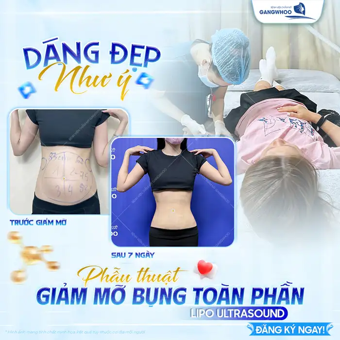 Hút mỡ có béo lại không? Nguyên nhân và cách phòng tránh