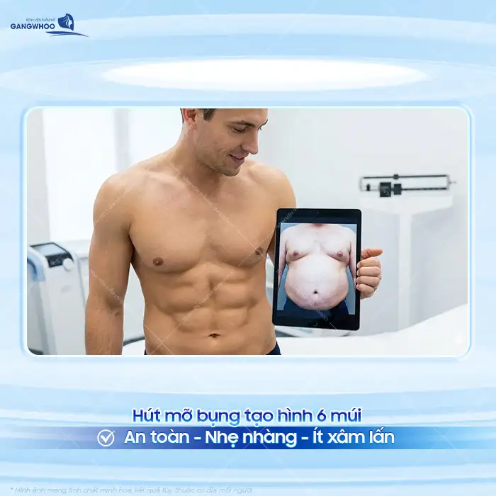 Hút mỡ bụng tạo hình 6 múi có hiệu quả không? Những ai nên thực hiện