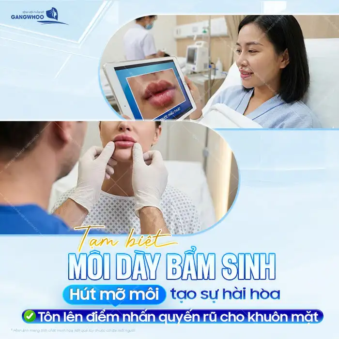 Phương pháp hút mỡ môi là gì? Có nên thực hiện hút mỡ môi?