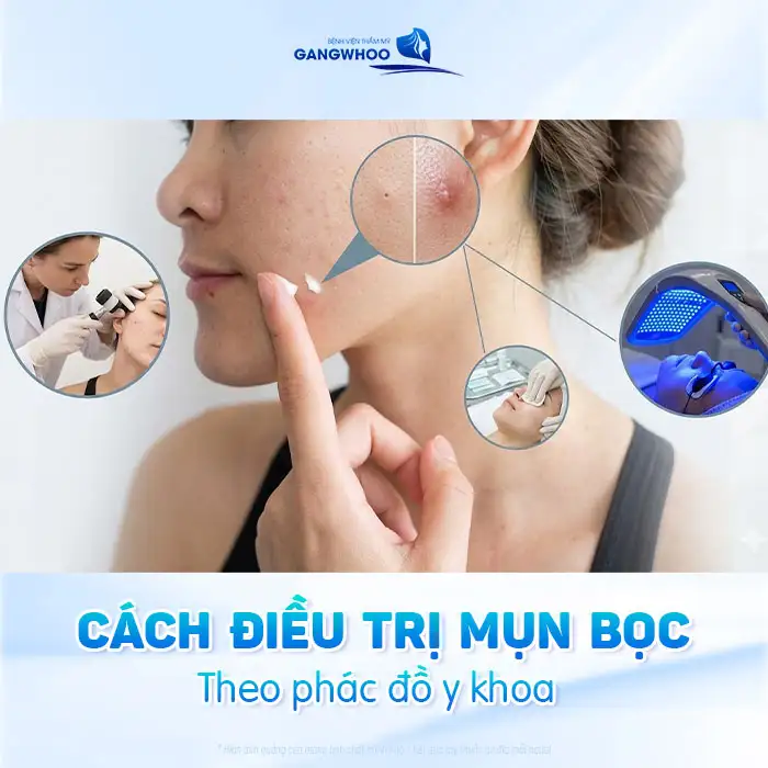Nguyên nhân gây mụn bọc và cách điều trị không để lại sẹo xấu