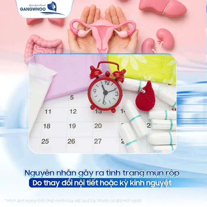 Mụn rộp ở môi và cách điều trị đúng cách để ngừa tái phát