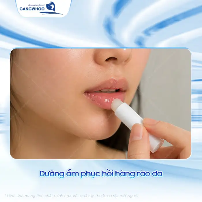 Mụn rộp ở môi và cách điều trị đúng cách để ngừa tái phát