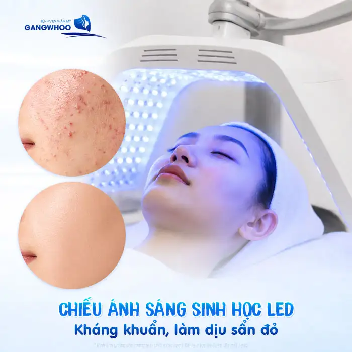 Mụn sẩn là gì? Cách điều trị mụn sẩn an toàn, hiệu quả