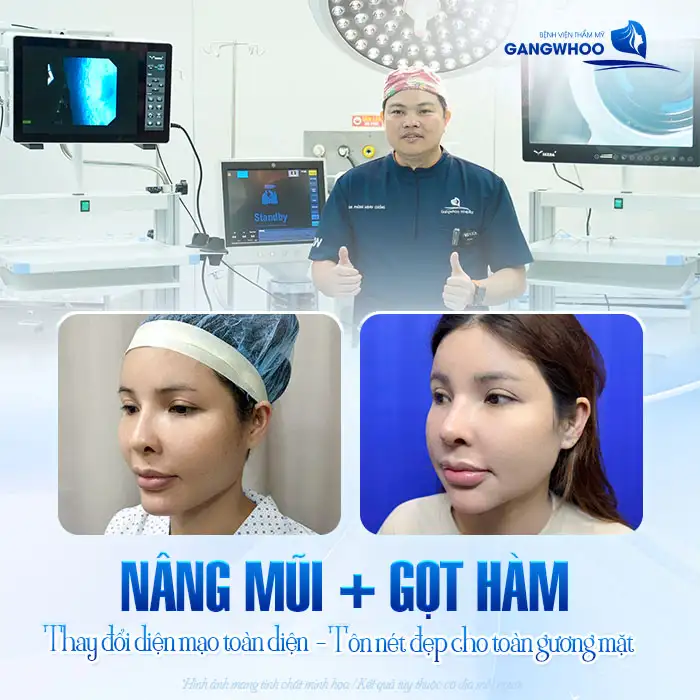 Nâng mũi gọt hàm cùng 1 lúc được không? Có ảnh hưởng sức khỏe