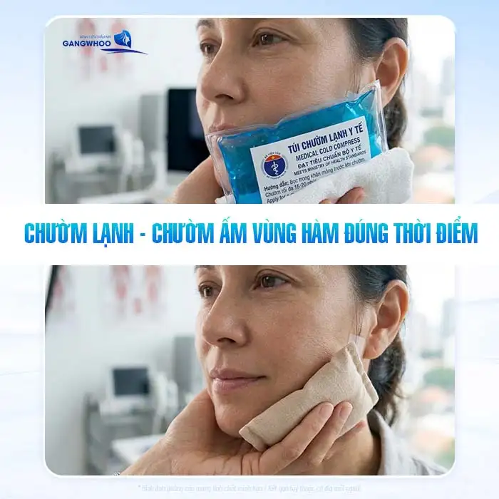Những điều cần biết khi phẫu thuật gọt hàm để đảm bảo an toàn, hiệu quả