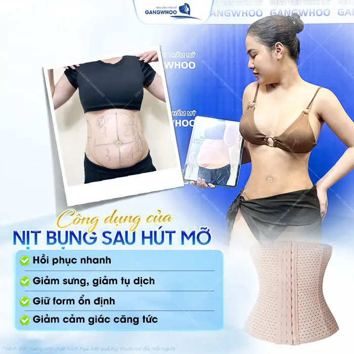 Vì sao phải đeo nịt bụng sau hút mỡ? Nên đeo nịt bụng bao lâu