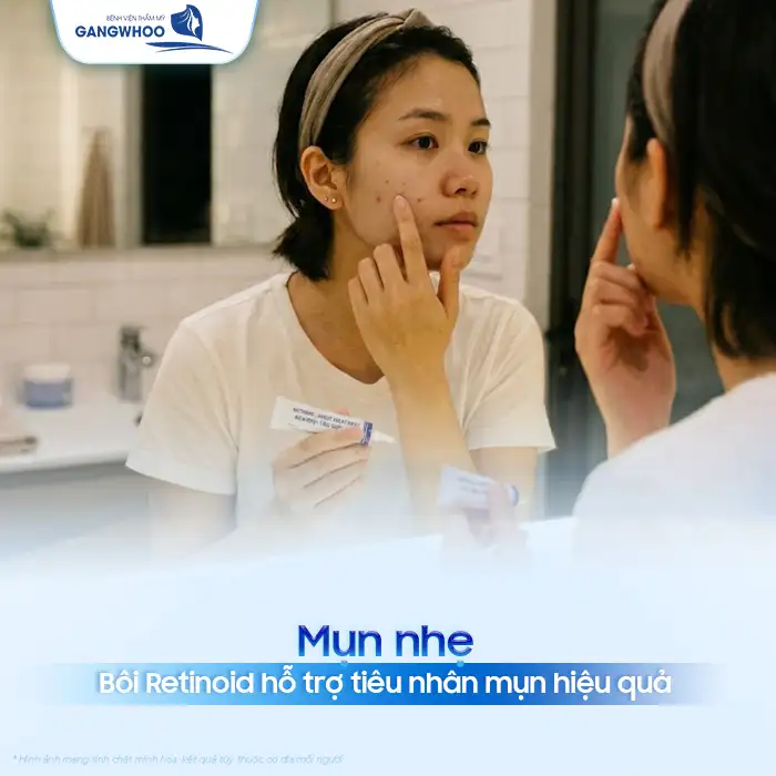 Phác đồ điều trị mụn trứng cá theo Bộ Y Tế bao gồm các bước nào