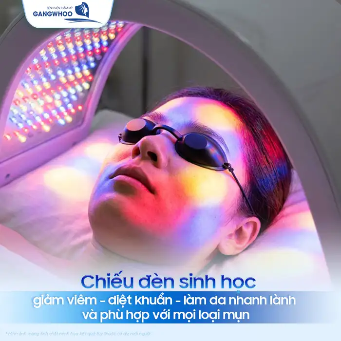 Phác đồ điều trị mụn trứng cá theo Bộ Y Tế bao gồm các bước nào