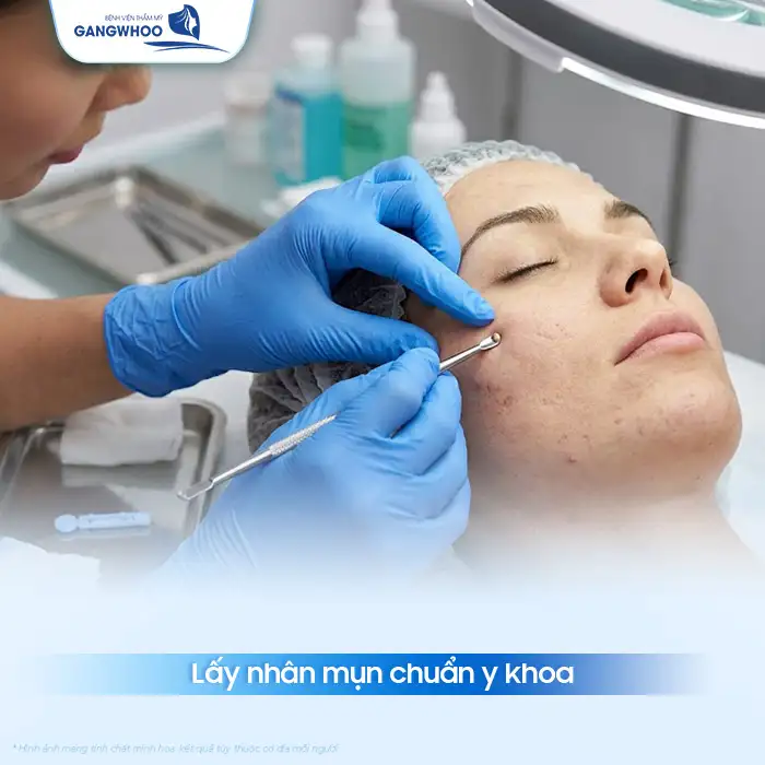 Phác đồ điều trị mụn trứng cá theo Bộ Y Tế bao gồm các bước nào