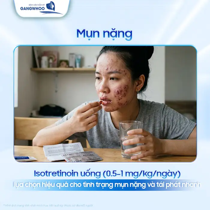 Phác đồ điều trị mụn trứng cá theo Bộ Y Tế bao gồm các bước nào