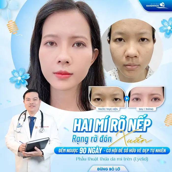 Phẫu thuật cắt mí mắt có nguy hiểm không? Những yếu tố cần lưu ý