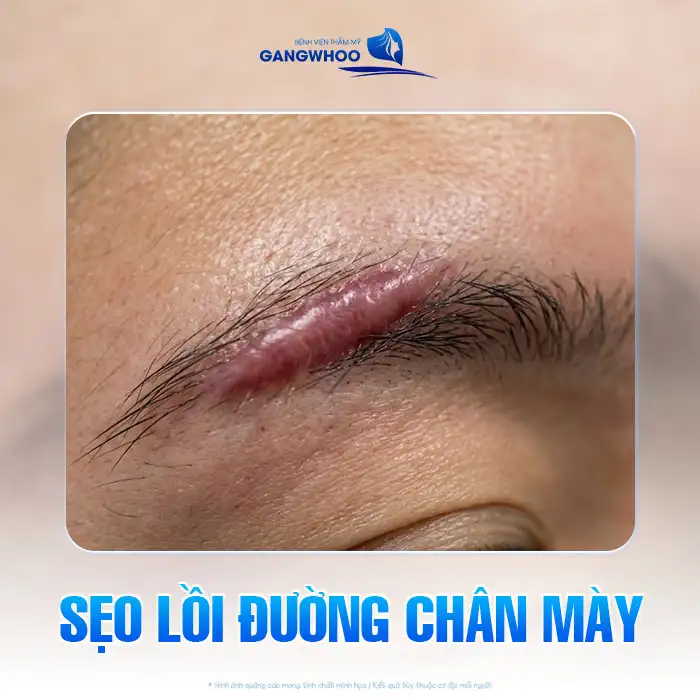Phun chân mày có ảnh hưởng gì không? Những lưu ý trước khi thực hiện