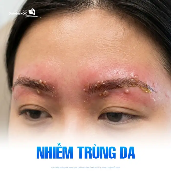Phun chân mày có ảnh hưởng gì không? Những lưu ý trước khi thực hiện