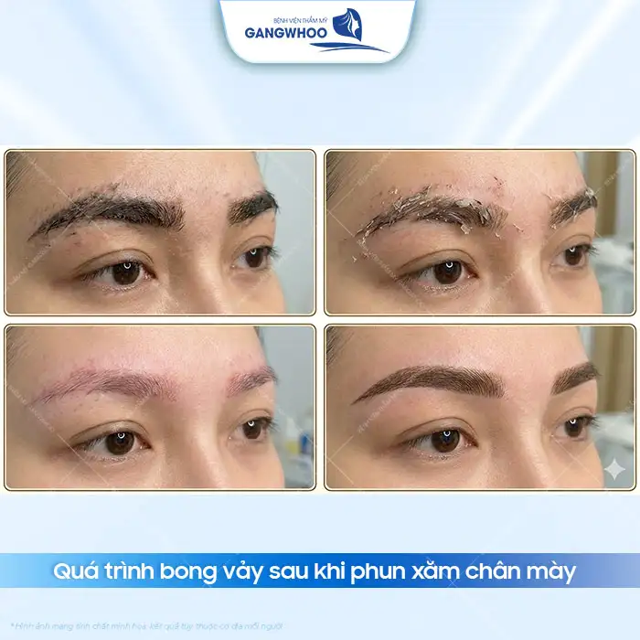 Phun chân mày bao lâu thì bong? Các giai đoạn hồi phục chi tiết