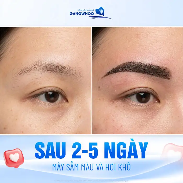 Phun lông mày bao lâu thì lên màu? Các giai đoạn hồi phục chuẩn
