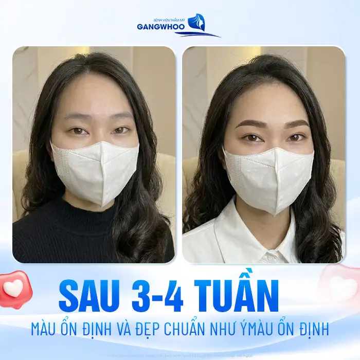 Phun lông mày bao lâu thì lên màu? Các giai đoạn hồi phục chuẩn
