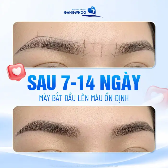Phun lông mày bao lâu thì lên màu? Các giai đoạn hồi phục chuẩn