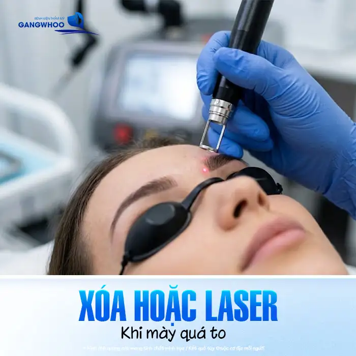 Phun lông mày bị to quá phải làm sao? Nguyên nhân và cách khắc phục