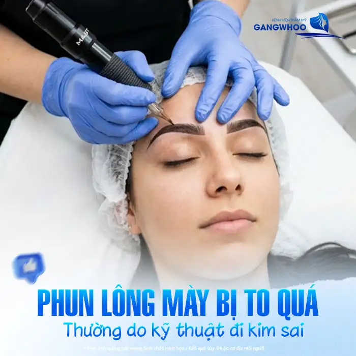 Phun lông mày bị to quá phải làm sao? Nguyên nhân và cách khắc phục
