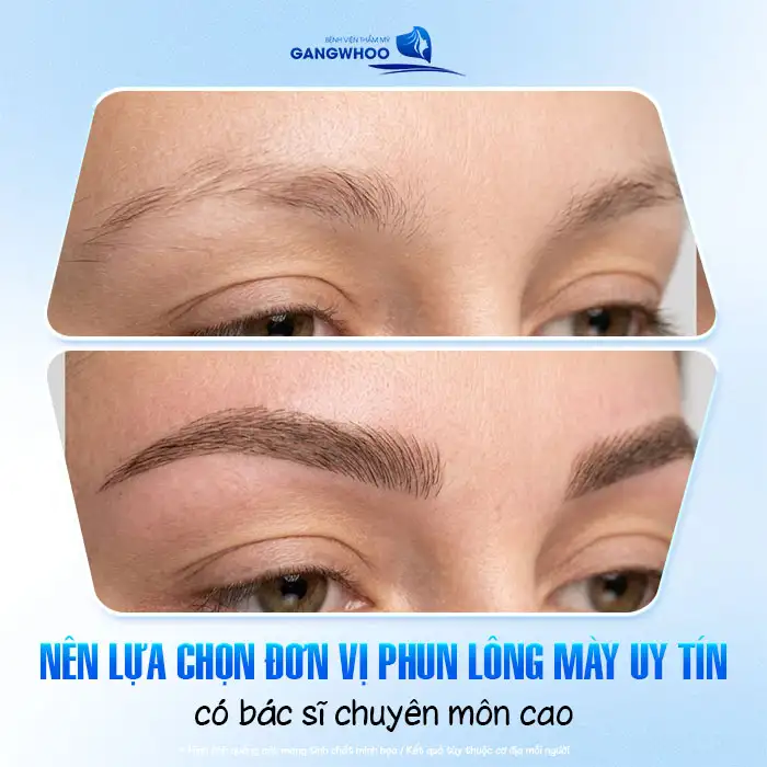Phun lông mày bị to quá phải làm sao? Nguyên nhân và cách khắc phục