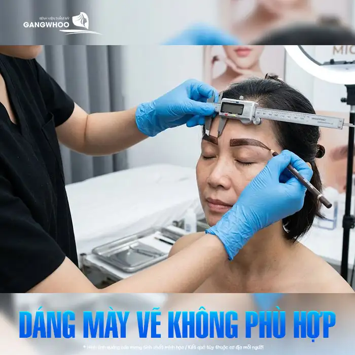 Phun lông mày bị to quá phải làm sao? Nguyên nhân và cách khắc phục