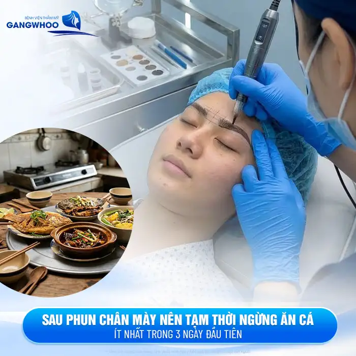 Phun mày có được ăn cá không? Bác sĩ giải đáp chế độ kiêng cần biết