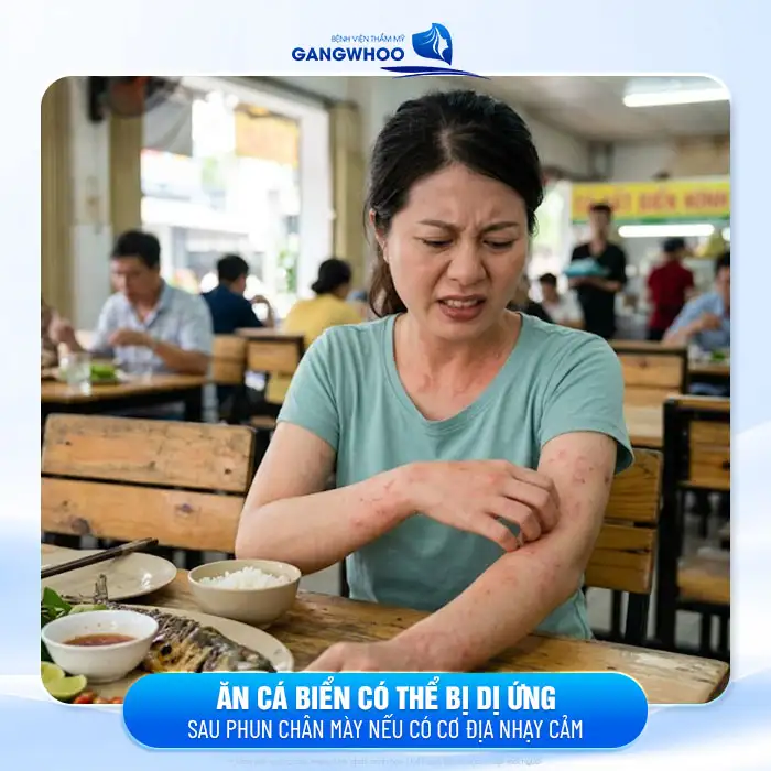 Phun mày có được ăn cá không? Bác sĩ giải đáp chế độ kiêng cần biết