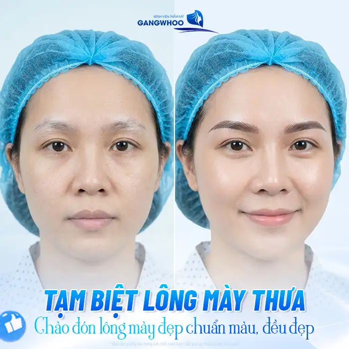 Phun mày hiệu ứng bút chì là gì? Ưu, nhược điểm như thế nào?
