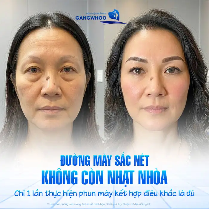 Phun mày kết hợp điêu khắc là gì? Ưu – nhược điểm và ai nên làm