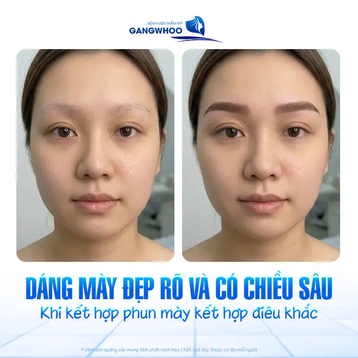 Phun mày kết hợp điêu khắc là gì? Ưu – nhược điểm và ai nên làm