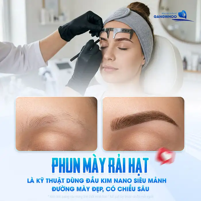 Phun mày rải hạt là gì? Có những ưu, nhược điểm ra sao?