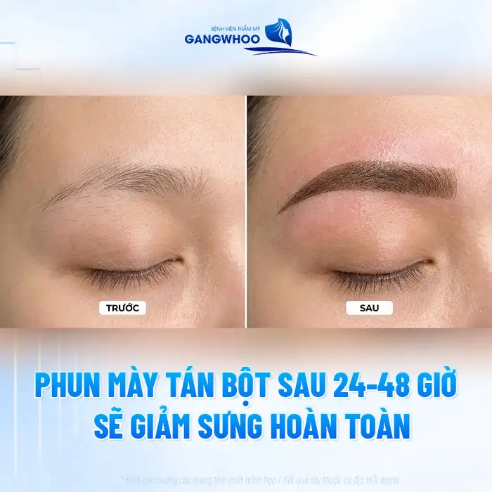 Phun mày tán bột có bị sưng không? Bao lâu thì hết sưng?
