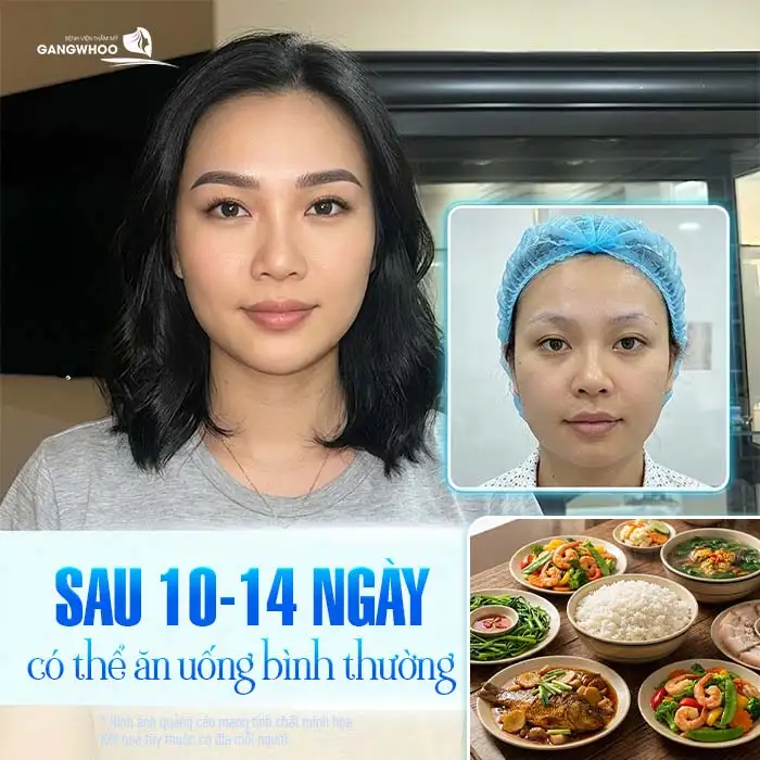 Phun mày tán bột kiêng ăn gì? Danh sách thực phẩm cần tránh
