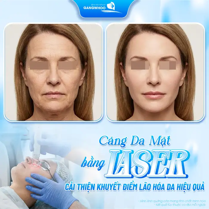 Phương pháp căng da mặt nào ? Tham khảo các phương pháp hiệu quả