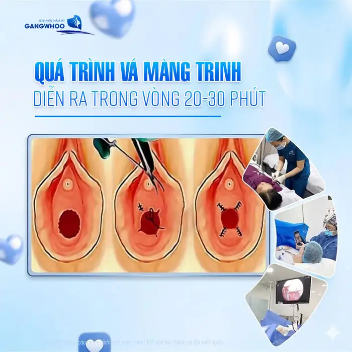 Quá trình vá màng trinh diễn ra như thế nào theo chuẩn y khoa